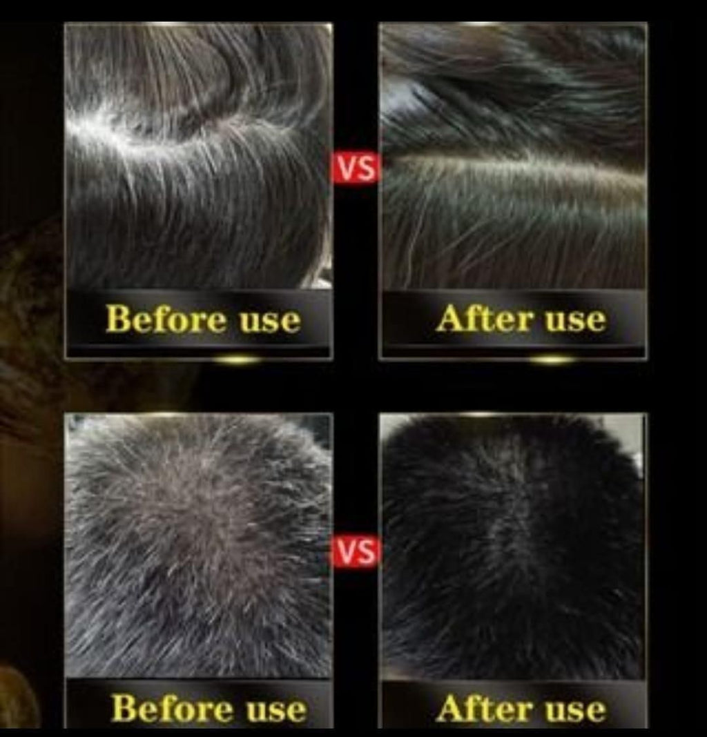 5-Minute Instant Black Hair Dye Shampoo – Herbal 3-in-1 Grey Coverage (Buy 1 Get 1)