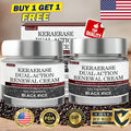 Biancat KeraErase Wart Remover Dual-Action Renewal Cream ( BUY 1 GET 1 FREE )